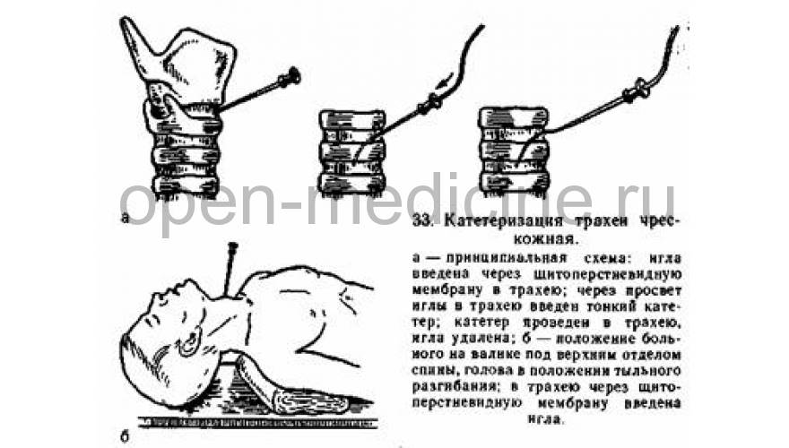 Как шить из мембраны Как шить из мембраны